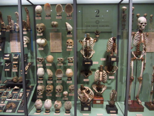 Photo 2: A vitrine showing the effects of fractures and diseases on the human skeleton, bones and skulls.